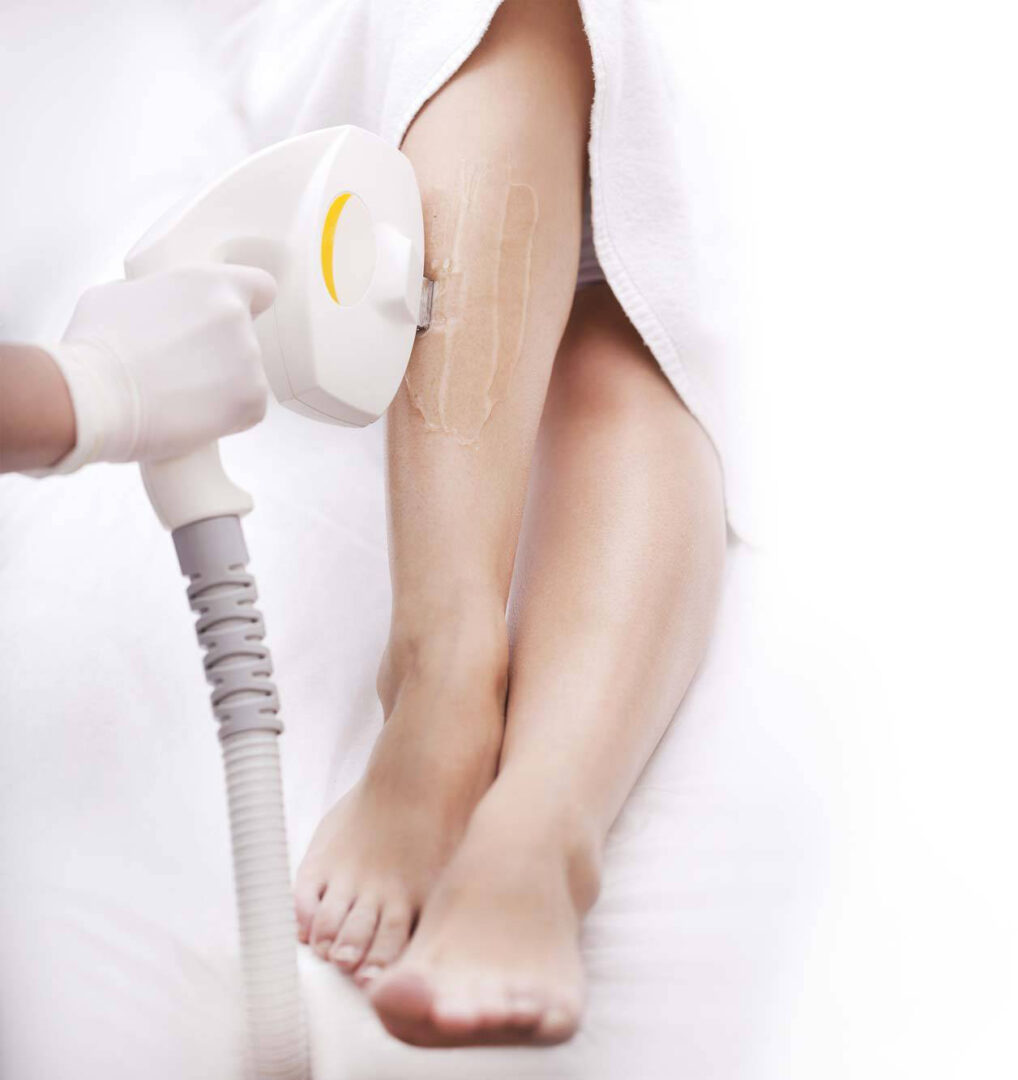 Épilation définitive des jambes au laser à Marseille